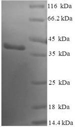 Human Sentrin-specific protease 8 (SENP8) Recombinant Protein, Homo sapiens (Human), E.coli, N-terminal 6xHis-SUMO-tagged, 40.1 kDa, purity >≥ 90% as determined by SDS-PAGE.