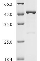 Mouse Z-DNA-binding protein 1 (Zbp1) Recombinant Protein, N-His-B2M - BioCrest Sci