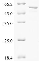Human Cytochrome P450 3A5 (CYP3A5) Recombinant Protein - BioCrest Sci