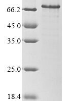 Human Interferon regulatory factor 1 (IRF1) Recombinant Protein, N-10His/C-GST - BioCrest Sci