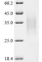 Dog Lysozyme C, milk isozyme Recombinant Protein - BioCrest Sci