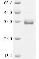 Staphylococcus aureus Glutamyl endopeptidase (sspA) Recombinant Protein - BioCrest Sci