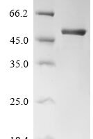 Human Enoyl-CoA hydratase, mitochondrial (ECHS1) Recombinant Protein - BioCrest Sci