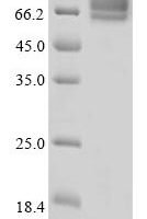 Mouse Desmoglein-3 (Dsg3), partial Recombinant Protein, N-10His - BioCrest Sci