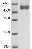 Human coronavirus OC43 Nucleoprotein (N) Recombinant Protein, C-hFc1 - BioCrest Sci