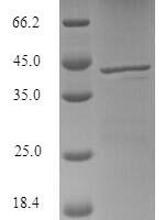 Bacillus licheniformis N-acetylmuramoyl-L-alanine amidase CwlM (cwlM) Recombinant Protein - BioCrest Sci