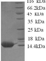 Horse Serum amyloid A protein (SAA1) Recombinant Protein - BioCrest Sci