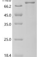 Human RAF proto-oncogene serine/threonine-protein kinase (RAF1) Recombinant Protein, C-His - BioCrest Sci