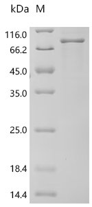 Human RAF proto-oncogene serine/threonine-protein kinase (RAF1) Recombinant Protein, C-His, Homo sapiens (Human), E.coli, C-terminal 6xHis-tagged, 80 kDa, purity >≥ 85% as determined by SDS-PAGE.
