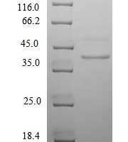 Human cytomegalovirus Uncharacterized protein UL130 (UL130), partial Recombinant Protein - BioCrest Sci