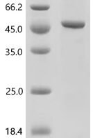 Human Tripartite motif-containing protein 29 (TRIM29), partial Recombinant Protein - BioCrest Sci
