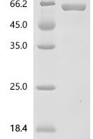 Mouse 5'-nucleotidase (Nt5e) Recombinant Protein - BioCrest Sci