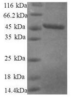 Human 40S ribosomal protein S10 (RPS10), partial Recombinant Protein - BioCrest Sci