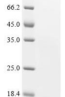 Human Bromodomain-containing protein 2 (BRD2), partial Recombinant Protein, N-His, aa 65–187, Yeast - BioCrest Sci