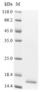 Human Bromodomain-containing protein 2 (BRD2), partial Recombinant Protein, N-His, aa 65–187, Yeast, Homo sapiens (Human), Yeast, N-terminal 6xHis-tagged, 16.6 kDa, purity >≥ 85% as determined by SDS-PAGE.