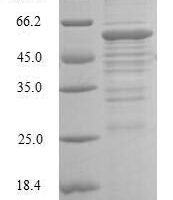 Human Dehydrogenase/reductase SDR family member 2, mitochondrial (DHRS2) Recombinant Protein - BioCrest Sci