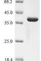 Mouse Galectin-4 (Lgals4) Recombinant Protein - BioCrest Sci