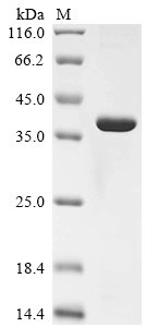 Mouse Galectin-4 (Lgals4) Recombinant Protein, Mus musculus (Mouse), E.coli, N-terminal 6xHis-tagged, 40.4 kDa, purity >≥ 85% as determined by SDS-PAGE.