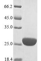 Vesicular stomatitis Indiana virus RNA-directed RNA polymerase L (L), partial Recombinant Protein - BioCrest Sci