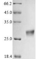 Aspergillus clavatus Ribonuclease clavin (cla) Recombinant Protein - BioCrest Sci