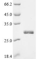 Human Serine protease 1 (PRSS1) Recombinant Protein, C-His, aa 24–247, Yeast - BioCrest Sci