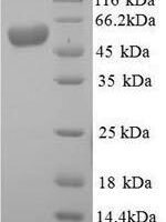 Human Intestinal-type alkaline phosphatase (ALPI) Recombinant Protein, N-His, aa 20–503, Yeast - BioCrest Sci