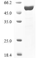 Human Dual specificity mitogen-activated protein kinase kinase 4 (MAP2K4) Recombinant Protein, N-10His/C-Myc - BioCrest Sci