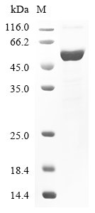 Human Dual specificity mitogen-activated protein kinase kinase 4 (MAP2K4) Recombinant Protein, N-10His/C-Myc, Homo sapiens (Human), E.coli, N-terminal 10xHis-tagged and C-terminal Myc-tagged, 51.6 kDa, purity >≥ 85% as determined by SDS-PAGE.