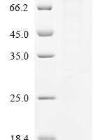Human Myb-related protein A (MYBL1) Recombinant Protein - BioCrest Sci