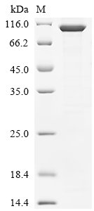Human Myb-related protein A (MYBL1) Recombinant Protein, Homo sapiens (Human), E.coli, N-terminal 10xHis-tagged and C-terminal Myc-tagged, 93.4 kDa, purity >≥ 85% as determined by SDS-PAGE.