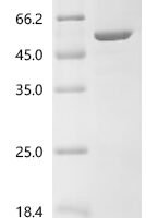Rickettsia slovaca Citrate synthase (gltA) Recombinant Protein, C-His, aa 1–435, E.coli - BioCrest Sci