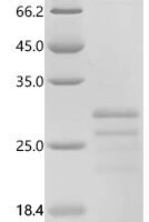 Mouse Placenta-expressed transcript 1 protein (Plet1) Recombinant Protein, N-His - BioCrest Sci