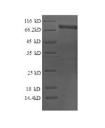 Human Calpain-2 catalytic subunit (CAPN2) Recombinant Protein, Homo sapiens (Human), E.coli, N-terminal 6xHis-tagged, 82.1 kDa, purity >≥ 90% as determined by SDS-PAGE.