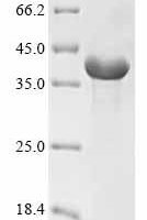 Hordeum vulgare B3-hordein Recombinant Protein - BioCrest Sci