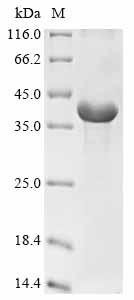 Hordeum vulgare B3-hordein Recombinant Protein, Hordeum vulgare (Barley), E.coli, N-terminal 6xHis-tagged, 36.2 kDa, purity >≥ 85% as determined by SDS-PAGE.