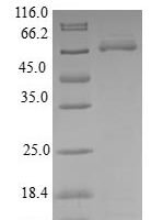 Human Kinetochore-associated protein DSN1 homolog (DSN1) Recombinant Protein - BioCrest Sci
