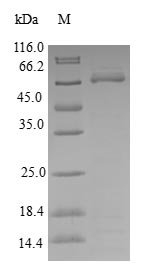 Human Kinetochore-associated protein DSN1 homolog (DSN1) Recombinant Protein, Homo sapiens (Human), E.coli, N-terminal GST-tagged, 67.1 kDa, purity >≥ 90% as determined by SDS-PAGE.