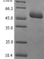 Human Mucosal addressin cell adhesion molecule 1 (MADCAM1), partial Recombinant Protein, N-His-SUMO - BioCrest Sci