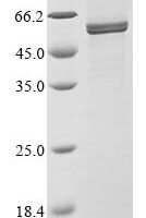 Human coronavirus 229E Nucleoprotein (N) Recombinant Protein, N-10His/C-Myc, aa 1–389, Mammalian cell - BioCrest Sci