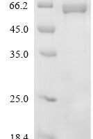 Mouse Protein disulfide-isomerase A2 (Pdia2) Recombinant Protein, C-His - BioCrest Sci