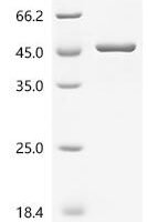 Mouse Sorbitol dehydrogenase (Sord) Recombinant Protein - BioCrest Sci