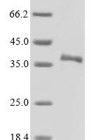 Mouse Secreted frizzled-related protein 5 (Sfrp5) Recombinant Protein, N-His - BioCrest Sci