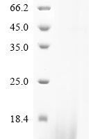 Dendroaspis angusticeps Dendrotoxin B, partial Recombinant Protein - BioCrest Sci
