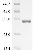Haemophilus influenzae Hybrid peroxiredoxin hyPrx5 (PGdx) Recombinant Protein - BioCrest Sci