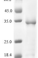 Enterobacteria phage PRD1 Spike protein P5 (V) Recombinant Protein, C-His - BioCrest Sci
