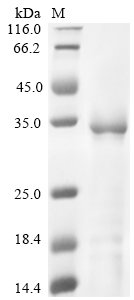 Enterobacteria phage PRD1 Spike protein P5 (V) Recombinant Protein, C-His, Enterobacteria phage PRD1 (Bacteriophage PRD1), Yeast, C-terminal 6xHis-tagged, 35.8 kDa, purity >≥ 90% as determined by SDS-PAGE.