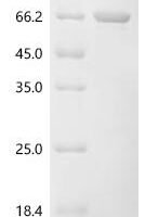 Human herpesvirus 2 Tegument protein VP16 (UL48) Recombinant Protein, C-His - BioCrest Sci