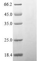 Escherichia coli Translational regulator CsrA (csrA) Recombinant Protein, N-His - BioCrest Sci
