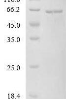 Human Transcription factor EB (TFEB) Recombinant Protein, C-His - BioCrest Sci