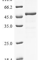 Human Transcobalamin-2 (TCN2), partial Recombinant Protein - BioCrest Sci